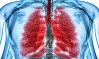 悦刻电子烟导致严重肺病？