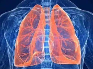 抽电子烟肺会有积液吗?先了解肺积液的原因